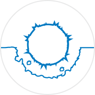 Aggressive cancer cells